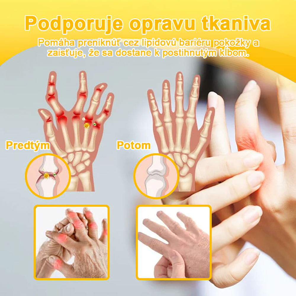 🏆【Oficiálny značkový obchod】𝐀𝐫𝐭𝐫𝐨𝐅𝐥𝐞𝐱𝐢𝐬™ 𝐊𝐫é𝐦 𝐧𝐚 𝐫𝐞𝐠𝐞𝐧𝐞𝐫á𝐜𝐢𝐮 𝐤ĺ𝐛𝐨𝐯 𝐬 𝐯č𝐞𝐥í𝐦 𝐣𝐞𝐝𝐨𝐦(Extrakt z novozélandského včelieho jedu - špecializovaný na ortopedické ochorenia - Certifikovaný CE)