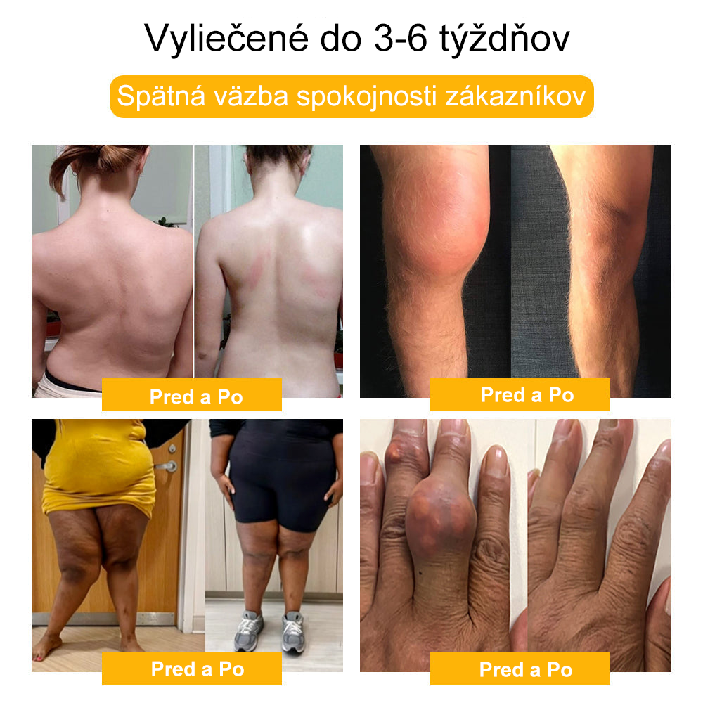 🏆【Oficiálny značkový obchod】𝐀𝐫𝐭𝐫𝐨𝐅𝐥𝐞𝐱𝐢𝐬™ 𝐊𝐫é𝐦 𝐧𝐚 𝐫𝐞𝐠𝐞𝐧𝐞𝐫á𝐜𝐢𝐮 𝐤ĺ𝐛𝐨𝐯 𝐬 𝐯č𝐞𝐥í𝐦 𝐣𝐞𝐝𝐨𝐦(Extrakt z novozélandského včelieho jedu - špecializovaný na ortopedické ochorenia - Certifikovaný CE)