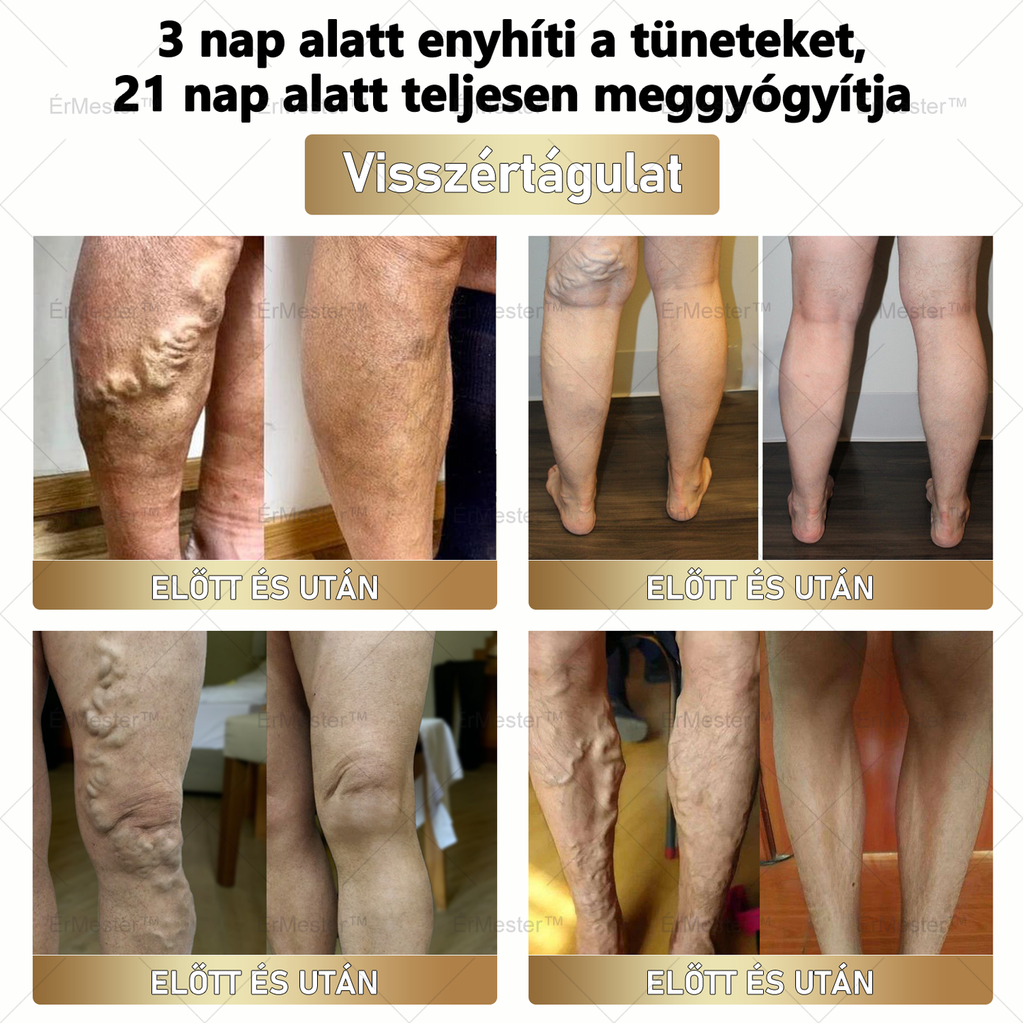 🏆 ÉrMester™ Természetes Vénás Javító Lábfürdő Gélgolyók
