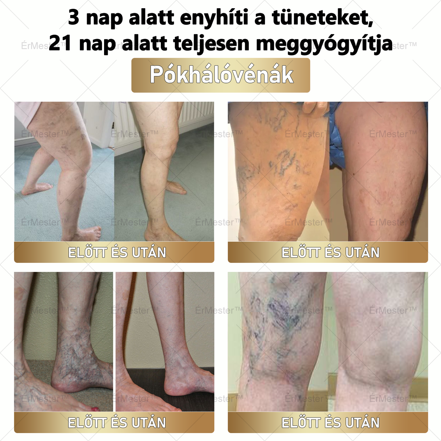 🏆 ÉrMester™ Természetes Vénás Javító Lábfürdő Gélgolyók