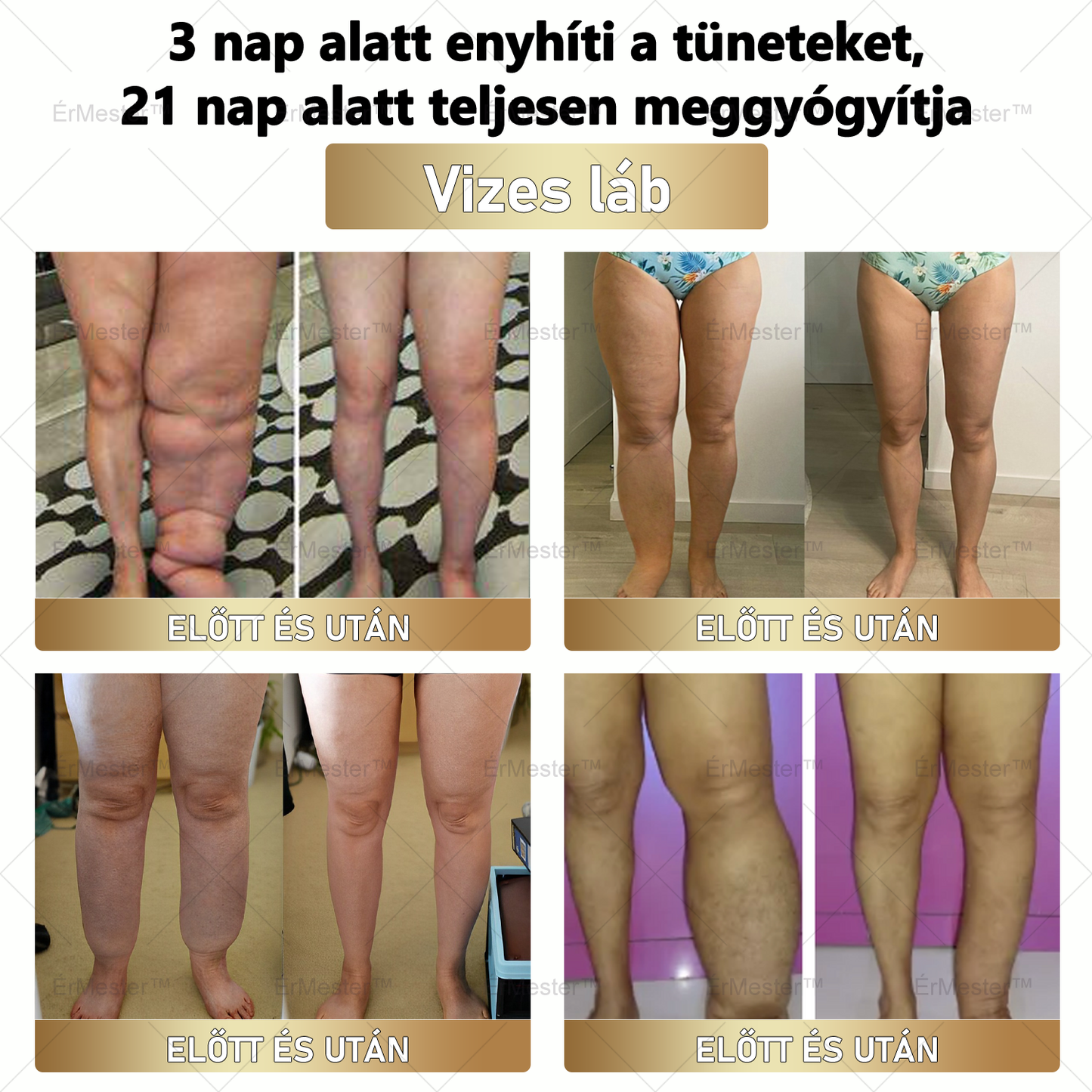 🏆 ÉrMester™ Természetes Vénás Javító Lábfürdő Gélgolyók