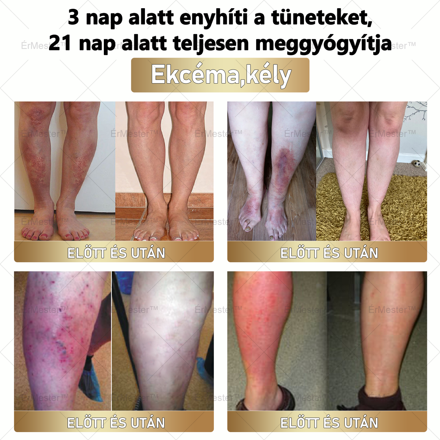 🏆 ÉrMester™ Természetes Vénás Javító Lábfürdő Gélgolyók