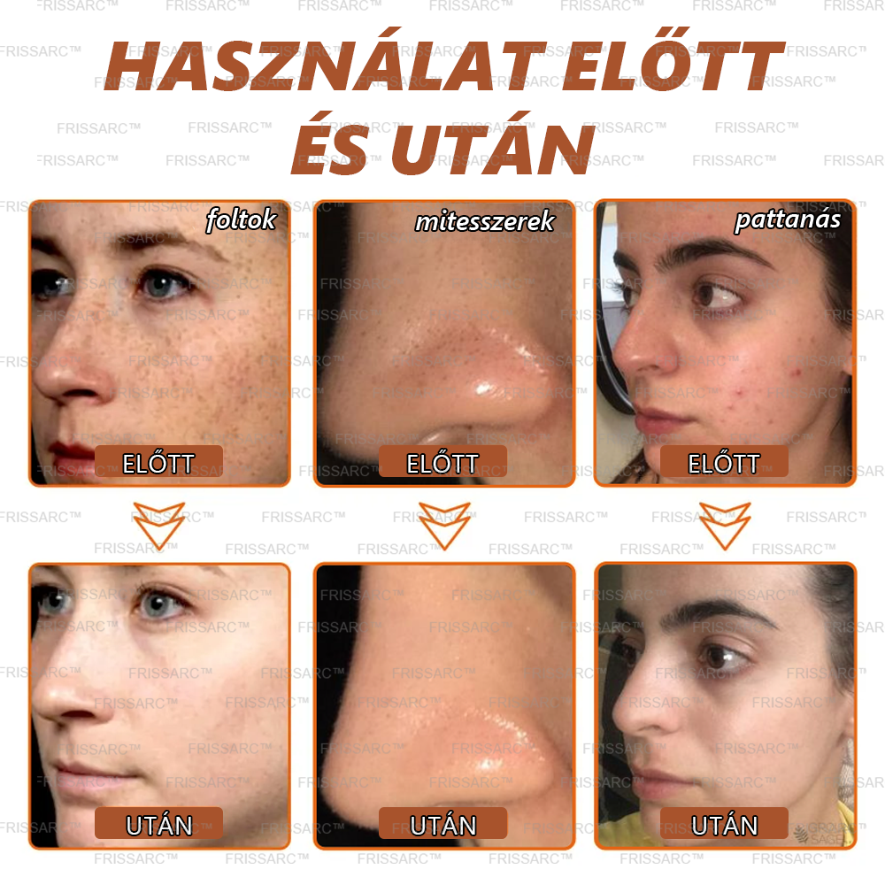 đž MĂ©lytisztĂtĂĄs, foltok eltƱnnek! A FRISSARCâą maszk segĂt, hogy bĆröd ragyogĂł fĂ©nyt kapjon, amit mĂ©g soha nem tapasztaltĂĄl!
