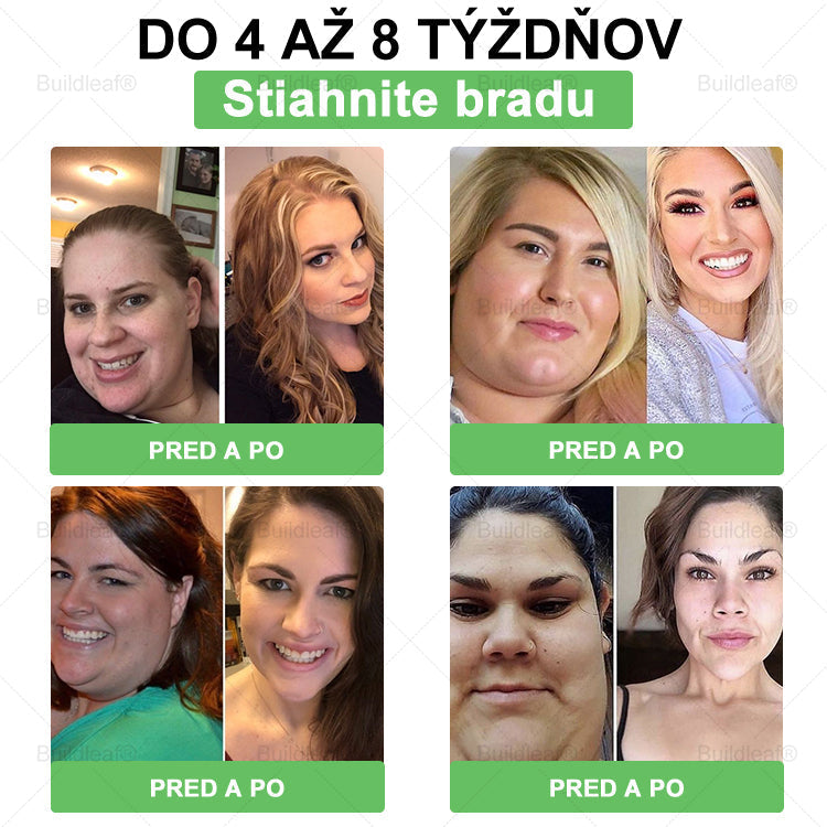 ✨BuildLeaf® GLP-1 6-v-1 Health Solution Perorálna tekutina (Len raz denne, viditeľné zmeny už za 7 dní) Pre obezitu, kardiovaskulárne ochorenia, cukrovku, spánkové apnoe, zdravie čriev, problémy s kĺbmi a ďalšie