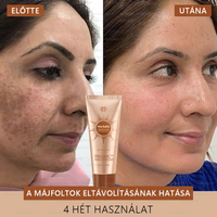 đFRISSARCâą fehĂ©rĂtĆ Ă©s folteltĂĄvolĂtĂł arcmaszk