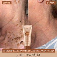 đFRISSARCâą fehĂ©rĂtĆ Ă©s folteltĂĄvolĂtĂł arcmaszk