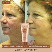 đFRISSARCâą fehĂ©rĂtĆ Ă©s folteltĂĄvolĂtĂł arcmaszk