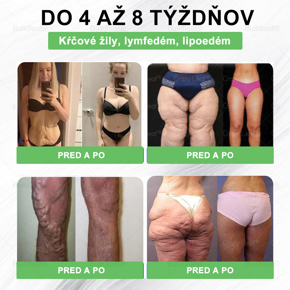 ✨BuildLeaf® GLP-1 6-v-1 Health Solution Perorálna tekutina (Len raz denne, viditeľné zmeny už za 7 dní) Pre obezitu, kardiovaskulárne ochorenia, cukrovku, spánkové apnoe, zdravie čriev, problémy s kĺbmi a ďalšie